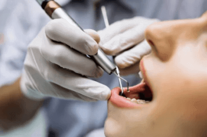 General dentistry — cleanings, fillings, exams